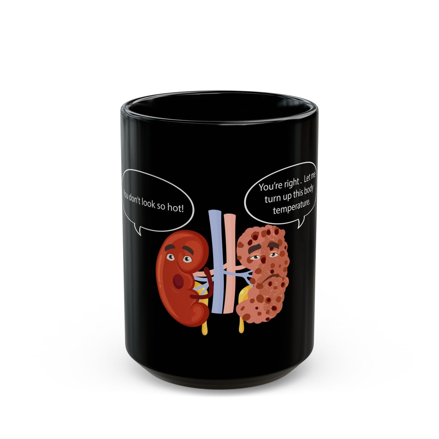 Kidney Sponge Talk Black Mug (11oz, 15oz) - Medical Humor