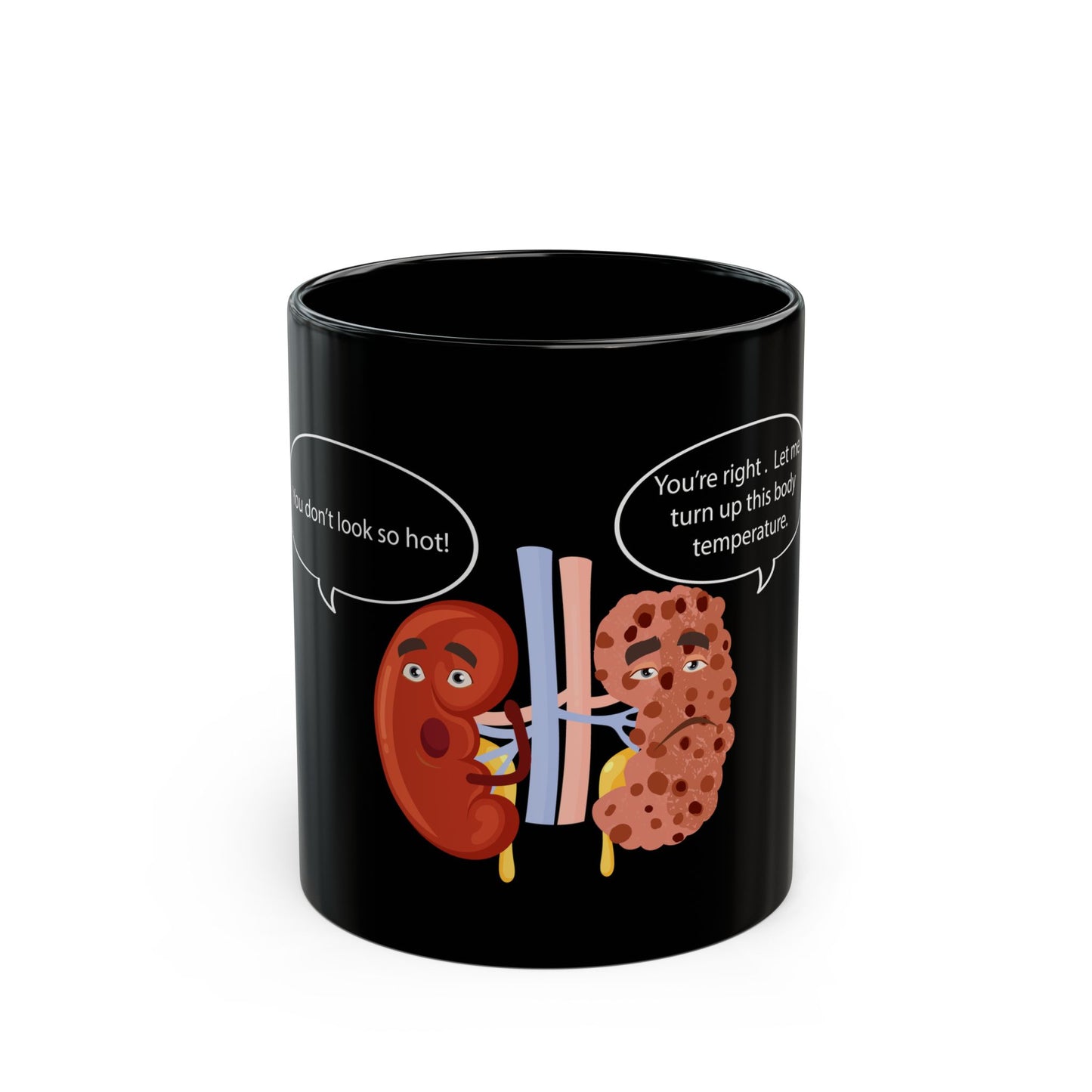 Kidney Sponge Talk Black Mug (11oz, 15oz) - Medical Humor